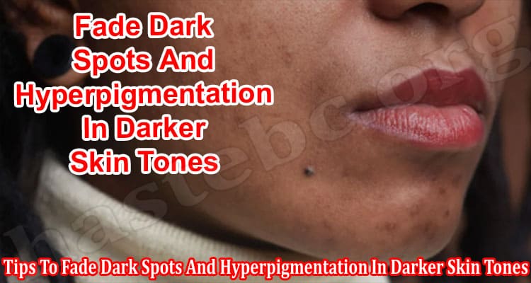Tips To Fade Dark Spots And Hyperpigmentation In Darker Skin Tones