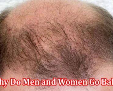 Why Do Men and Women Go Bald？