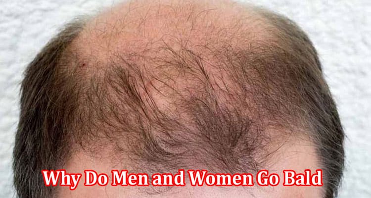 Why Do Men and Women Go Bald