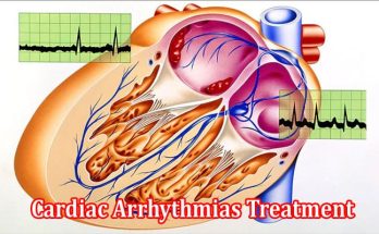 A Comprehensive Overview of Cardiac Arrhythmias Treatment
