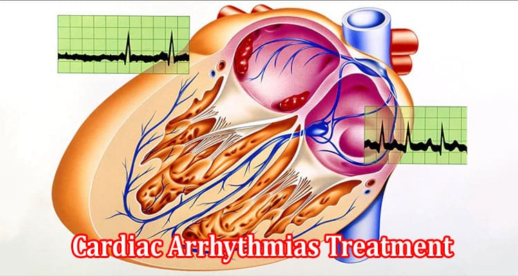 A Comprehensive Overview of Cardiac Arrhythmias Treatment
